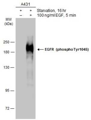 Western Blot: EGFR [p Tyr1045] Antibody [NBP3-13229] - Untreated (-) and treated (+) A431 whole cell extract (30 ug) were separated by 7.5% SDS-PAGE, and the membrane was blotted with EGFR (phospho Tyr1045) antibody (NBP3-13229) diluted at 1:2000. The HRP-conjugated anti-rabbit IgG antibody (NBP2-19301) was used to detect the primary antibody.